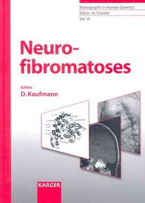 Neurofibromatoses de Dieter Kaufmann