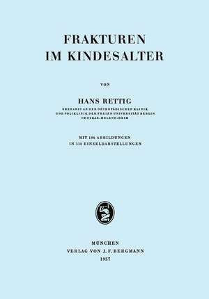 Frakturen im Kindesalter de Hans Rettig