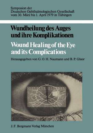 Wundheilung des Auges und ihre Komplikationen / Wound Healing of the Eye and its Complications: Symposion der Deutschen Ophthalmologischen Gesellschaft vom 30. März bis 1. April 1979 in Tübingen de G. O. H. Naumann