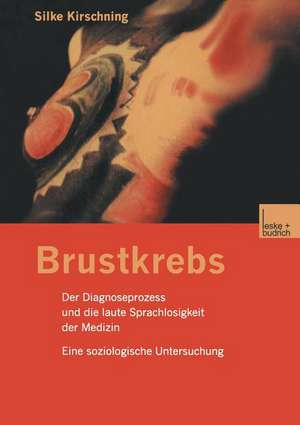 Brustkrebs: Der Diagnoseprozess und die laute Sprachlosigkeit der Medizin Eine soziologische Untersuchung de Silke Kirschning