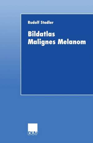 Bildatlas Malignes Melanom de Rudolf Stadler