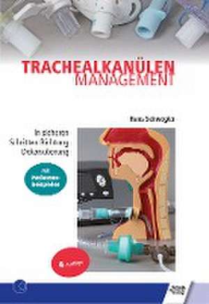 Trachealkanülenmanagement de Hans Schwegler