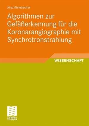 Algorithmen zur Gefäßerkennung für die Koronarangiographie mit Synchrotronstrahlung de Jörg Mielebacher