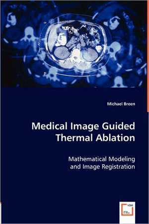 Medical Image Guided Thermal Ablation de Michael Breen