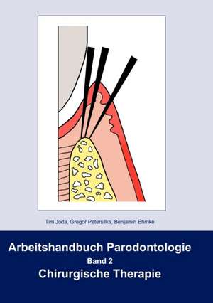 Arbeitshandbuch Parodontologie de Tim Joda