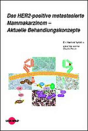 Das HER2-positive metastasierte Mammakarzinom - Aktuelle Behandlungskonzepte de Manfred Welslau