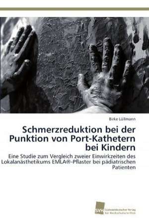 Schmerzreduktion Bei Der Punktion Von Port-Kathetern Bei Kindern: An Alternative Succession Route for Family Firms de Birke Lüllmann