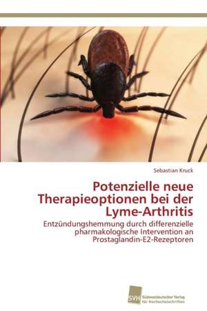 Potenzielle neue Therapieoptionen bei der Lyme-Arthritis de Sebastian Kruck