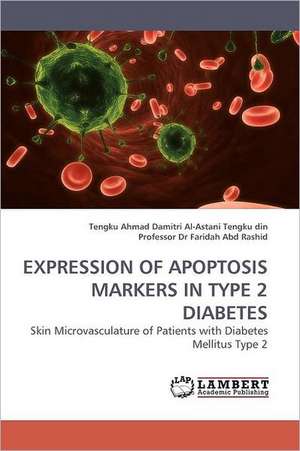 Expression of Apoptosis Markers in Type 2 Diabetes de Tengku Ahmad Damitri Al-Asta Tengku din