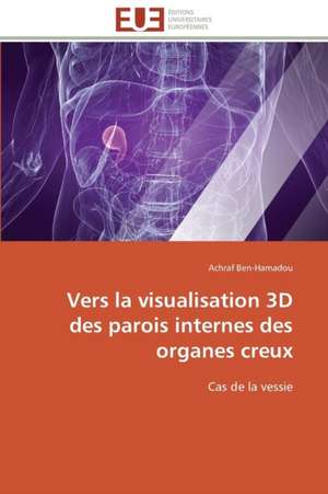 Vers La Visualisation 3D Des Parois Internes Des Organes Creux: France Et Russie de Achraf Ben-Hamadou