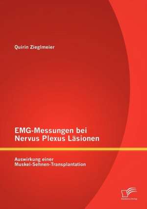 Emg-Messungen Bei Nervus Plexus L Sionen: Auswirkung Einer Muskel-Sehnen-Transplantation de Quirin Zieglmeier