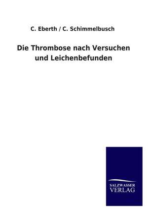 Die Thrombose Nach Versuchen Und Leichenbefunden: Die Bruder Vom Deutschen Hause / Marcus Konig de C. Eberth