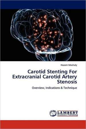 Carotid Stenting For Extracranial Carotid Artery Stenosis de Hazem Mashaly