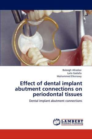 Effect of dental implant abutment connections on periodontal tissues de Baleegh Alkadasi