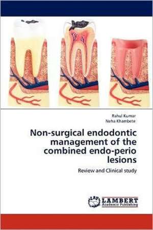 Non-surgical endodontic management of the combined endo-perio lesions de Rahul Kumar