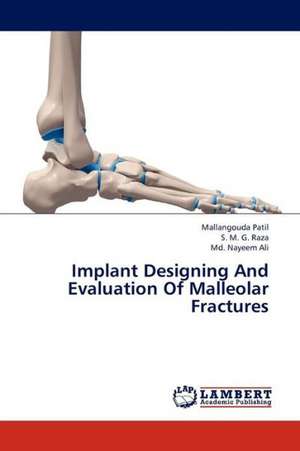 Implant Designing And Evaluation Of Malleolar Fractures de Patil Mallangouda