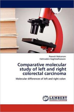 Comparative molecular study of left and right colorectal carcinoma de Pooneh Mokarram