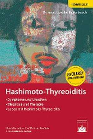 Hashimoto-Thyreoiditis de Leveke Brakebusch