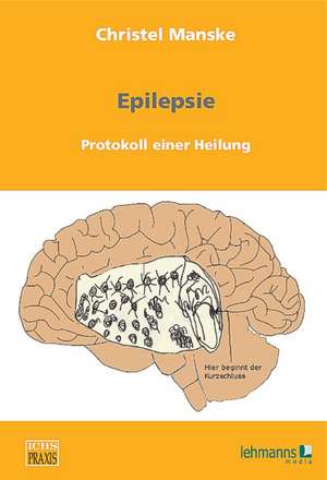 Epilepsie: Protokoll einer Heilung de Christel Manske