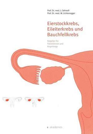 Sehouli, J: Eierstockkrebs, Eileiterkrebs und Bauchfellkrebs