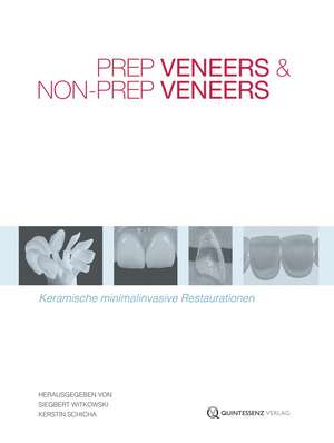 Prep Veneers und Non-Prep Veneers de Siegbert Witkowski