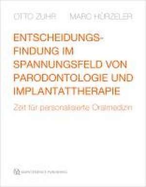 Entscheidungsfindung im Spannungsfeld von Parodontologie und Implantattherapie de Otto Zuhr