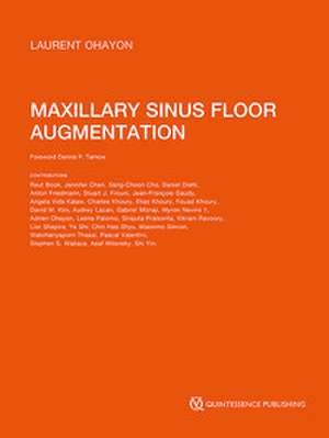 Maxillary Sinus Floor Augmentation de Laurent Ohayon