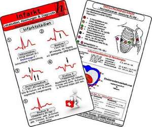 Infarkt - Lokalisation, Ableitungen & Diagnostik - Medizinische Taschen-Karte