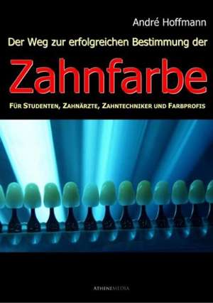 Der Weg zur erfolgreichen Bestimmung der Zahnfarbe de André Hoffmann