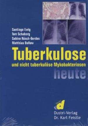 Tuberkulose und nicht tuberkulöse Mykobakteriosen heute de Santiago Ewig