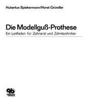 Die Modellguss-Prothese de Hubertus Spiekermann