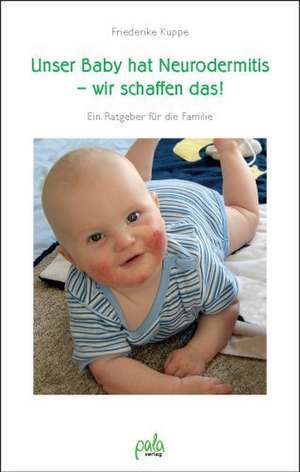 Unser Baby hat Neurodermitis - wir schaffen das! de Friederike Kuppe