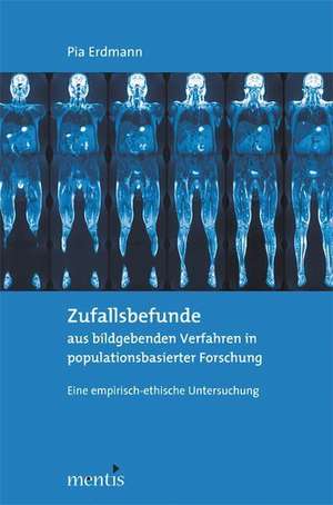 Zufallsbefunde aus bildgebenden Verfahren in populationsbasierter Forschung de Pia Erdmann