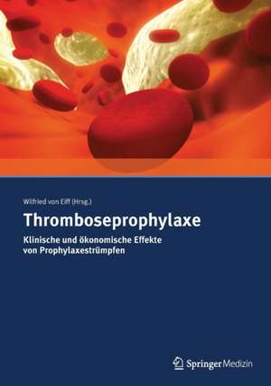 Thromboseprophylaxe Klinische und ökonomische Effekte von Prophylaxestrümpfen de Wilfried von Eiff