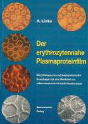 Der erythrozytennahe Plasmaproteinfilm de Arno Linke