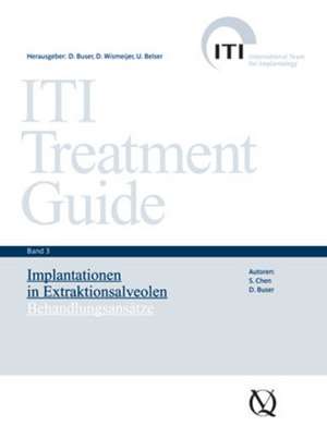 ITI Treatment Guide Band 3 de J. S. Chen