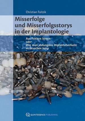 Misserfolge und Misserfolgsstorys in der Implantologie: Aus Fehlern lernen oder Wie man ahnungslos Implantatverluste verursachen kann de Christian Foitzik