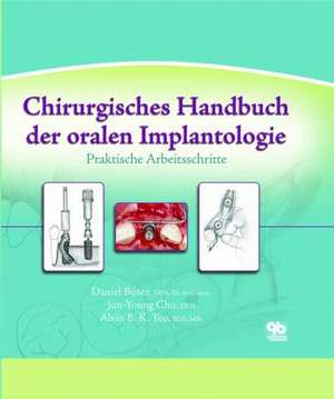 Chirurgisches Handbuch der oralen Implantologie de Daniel Buser