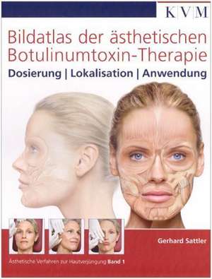 Hands-on 01. Bildatlas der ästhetischen Botulinumtoxin-Therapie de Gerhard Sattler