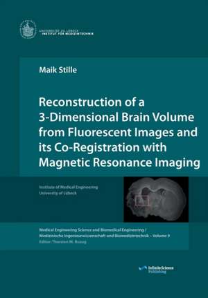 Reconstruction of a 3-Dimensional Brain Volume from Fluorescent Images and its Co-Registration with Magnetic Resonance Imaging de Maik Stille