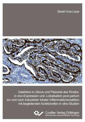 Galektine in Uterus und Plazenta des Rindes. in vivo-Expression und -Lokalisation post partum vor und nach induzierter lokaler Inflammationsreaktion mit begleitenden funktionellen in vitro-Studien de Sarah Eva Laue