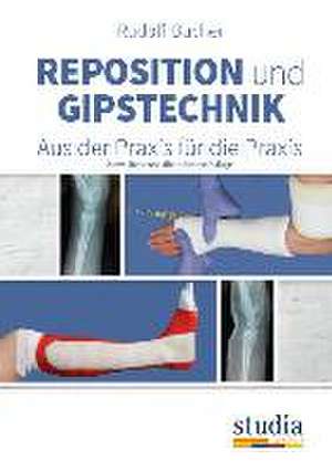 Reposition und Gipstechnik II de Rudolf Bucher