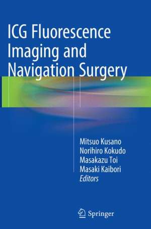 ICG Fluorescence Imaging and Navigation Surgery de Mitsuo Kusano