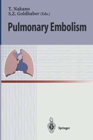 Pulmonary Embolism de Takeshi Nakano