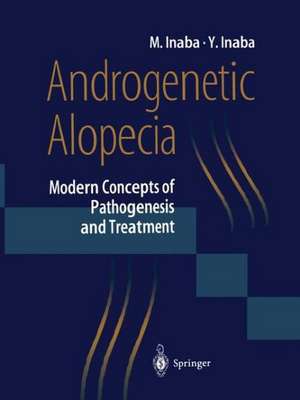 Androgenetic Alopecia: Modern Concepts of Pathogenesis and Treatment de Masumi Inaba