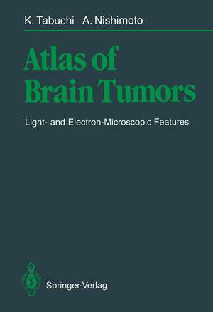 Atlas of Brain Tumors: Light- and Electron-Microscopic Features de Kazuo Tabuchi