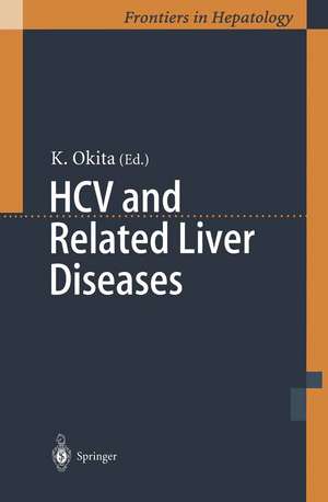 HCV and Related Liver Diseases de Kiwamu Okita