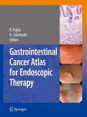 Gastrointestinal Cancer Atlas for Endoscopic Therapy de Rikiya Fujita