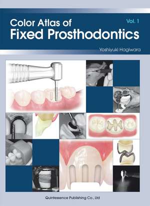 Color Atlas of Fixed Prosthodontics: Vol. 1 de Yoshiyuki Hagiwara