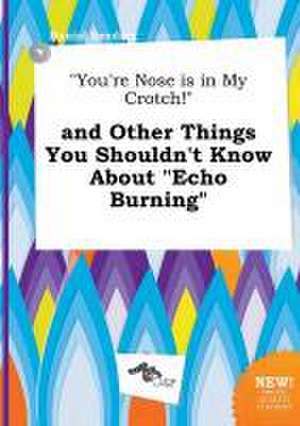 You're Nose Is in My Crotch! and Other Things You Shouldn't Know about Echo Burning de Daniel Seeding